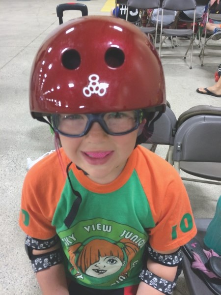 Darby Beeson, 9, was born with a unilateral clubfoot, but is now involved in numerous sporting activities thanks to treatment.