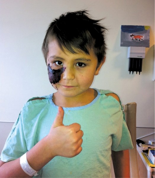 Cochrane resident Tyler Benjamin, 7, gives the thumbs up at Alberta Children&#8217;s Hospital on Jan. 22..