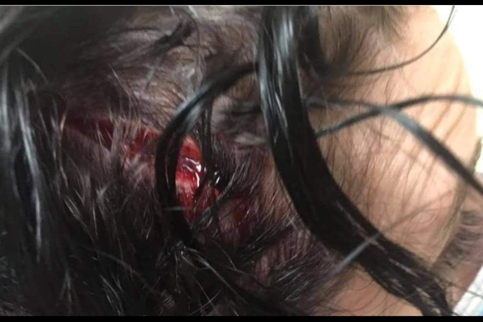 This Facebook photo shows the serious head injury suffered by the victim of a robbery in downtown Barrie late last week.