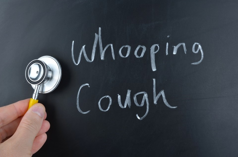 whooping cough shutterstock_283563977 2016