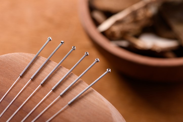 Acupuncture-Jordan Lye-Moment-Getty Images