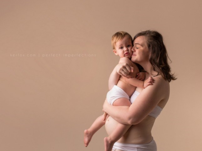 These Post Pregnancy Body Photos Are The Ultimate Lesson In Confidence