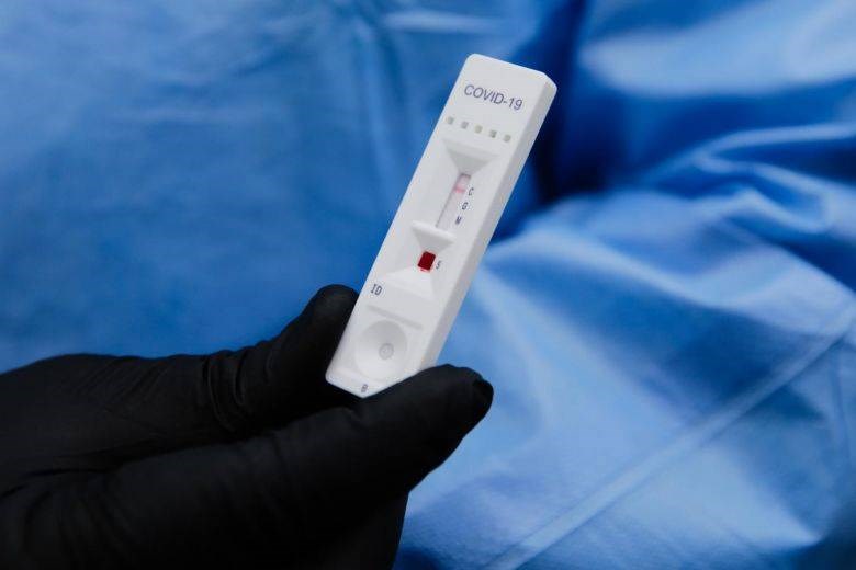 Covid-19 Antibody Test