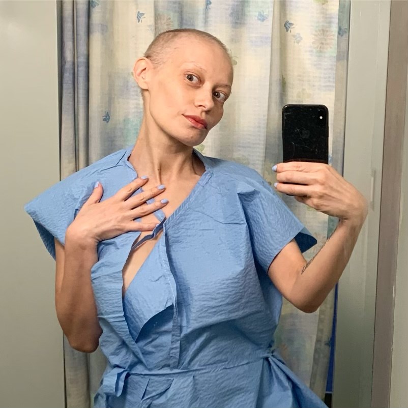 When the nails match the hospital gown. Photo: provided.