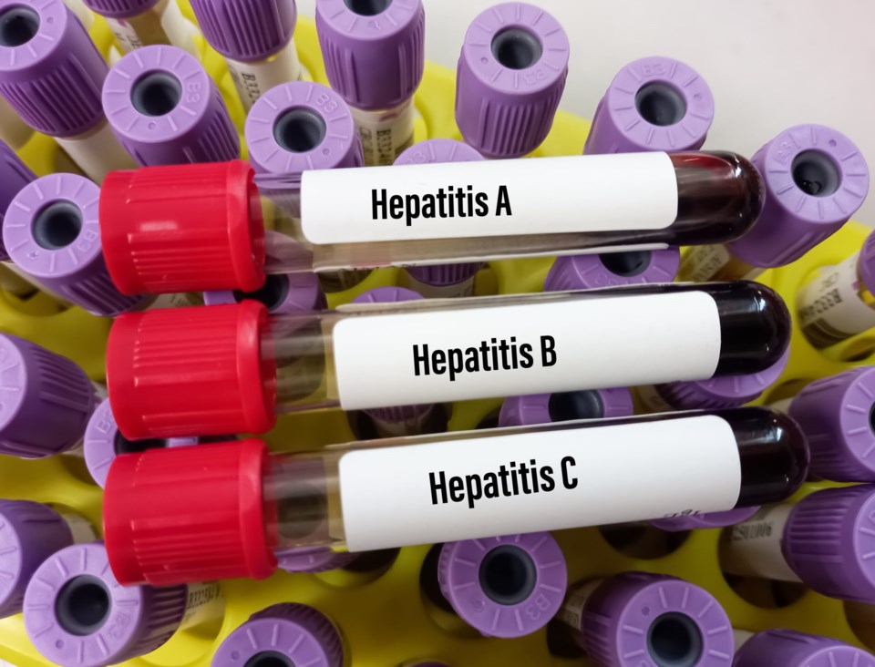 Blood,Samples,Tube,With,Sample,For,Hepatitis,Virus,Test,(hepatitis