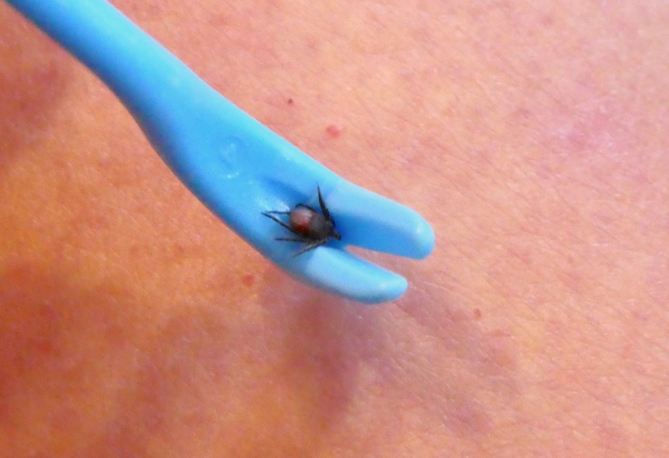 Tick on a tick remover