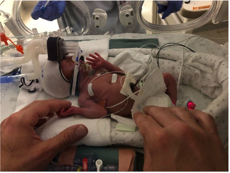 Jasper in an incubator