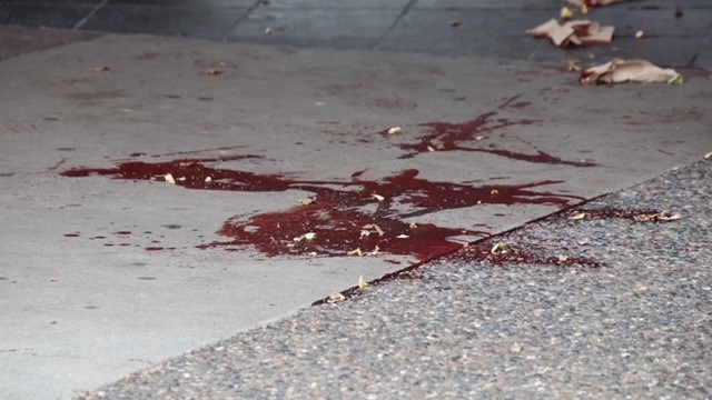 New Westminster Police Department officers are investigating the stabbing incident, which occurred at around 2 a.m. out front of the Paramount Gentlemen’s Club, an adult entertainment business on Columbia Street.