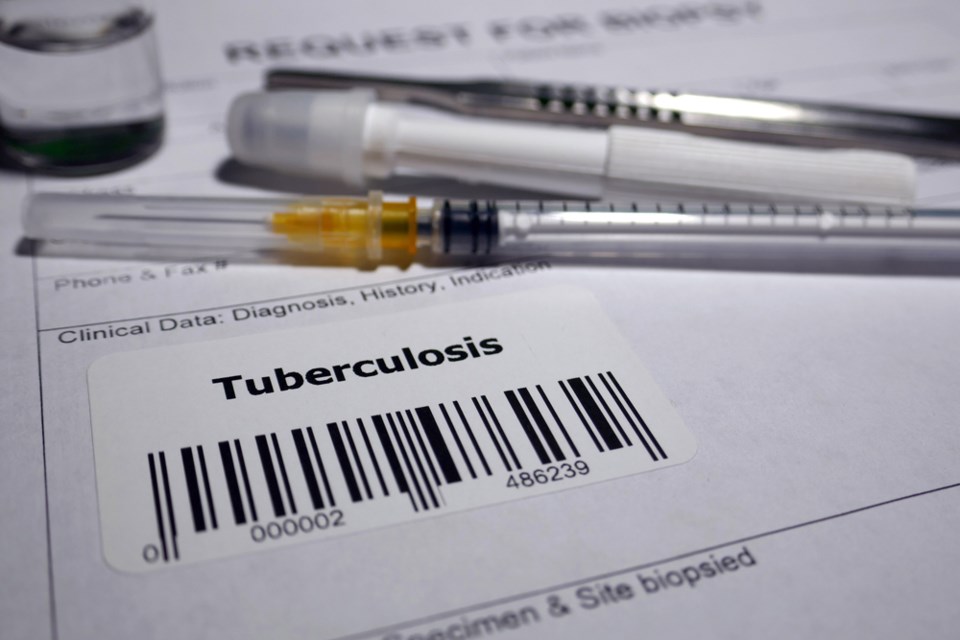tuberculosistesting