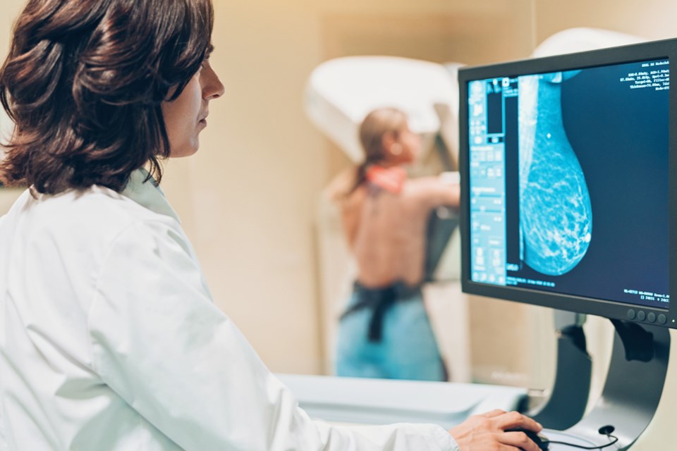 mammography_screening