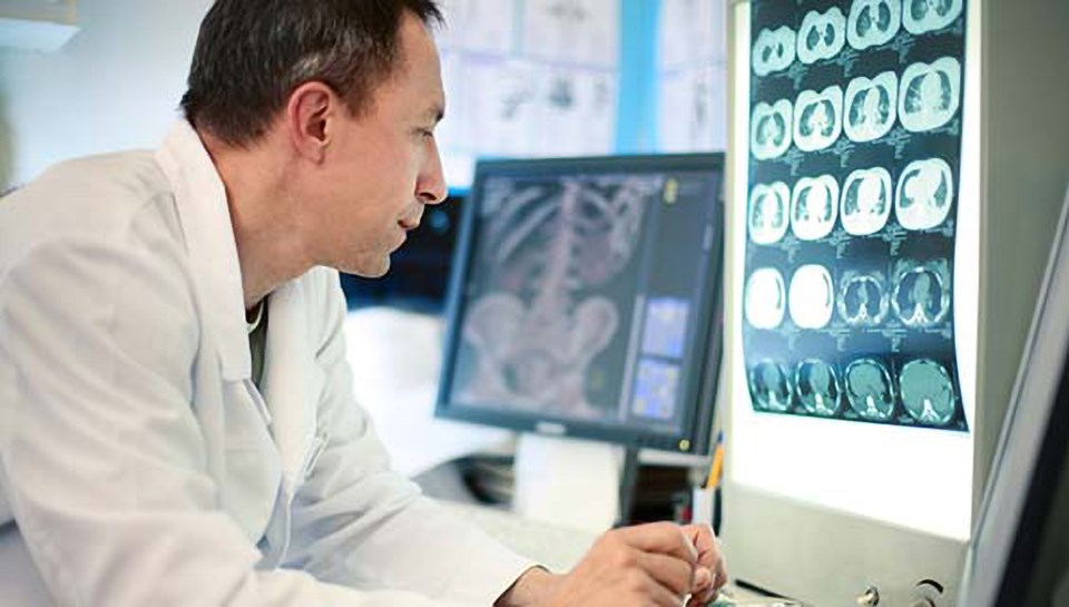alzheimers-nih