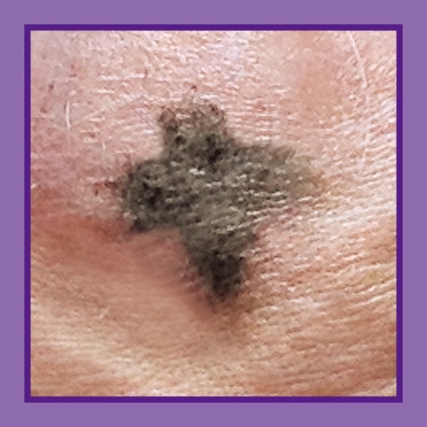 A smudge of ashes in form of a cross on foreheads on Ash Wednesday marks the beginning of Lent for many Christians.
