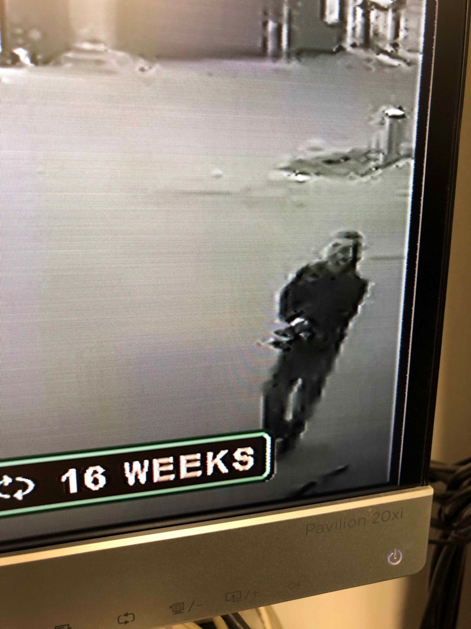 NAPA 4