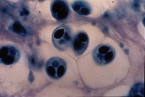 The normally uniform trout cartilage is scarred with lesions in which myxobolus cerebralis spores feed and develop, weakening and deforming the connective tissues. Wikimedia commons photo.