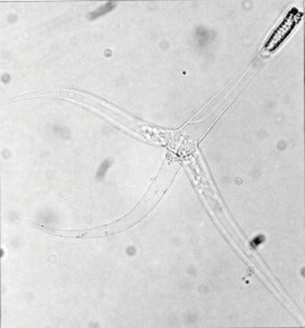 A microscopic view of a TAM (a mature spore) that causes whirling disease in fish. Wikimedia commons photo.