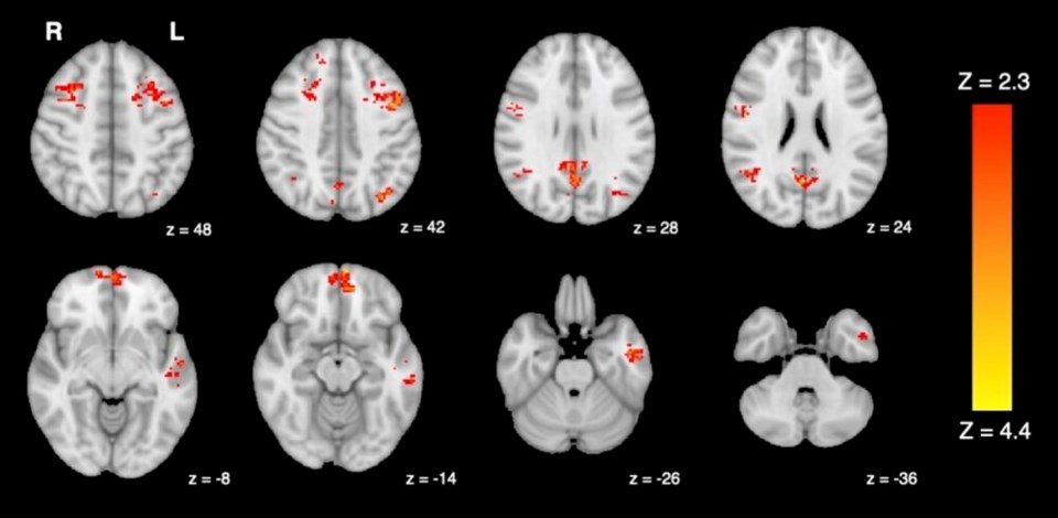 fmri-shows-decreased-functional-connectivity-after-exposure-to-car-exhaust