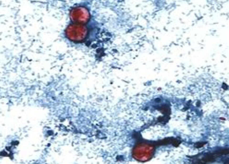 cyclospora-parasite-oocysts