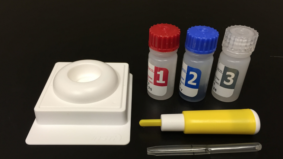 biolytical_ebola_test