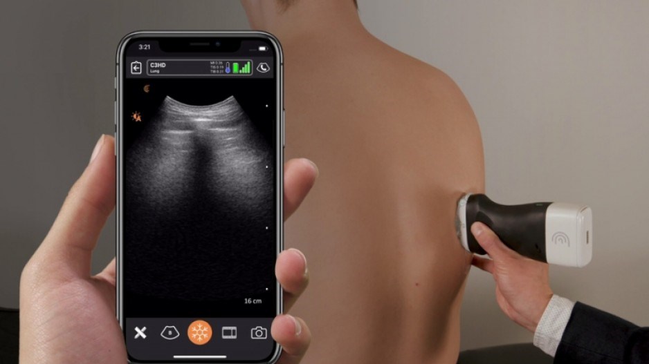 clarius-pocket-ultrasound-submitted