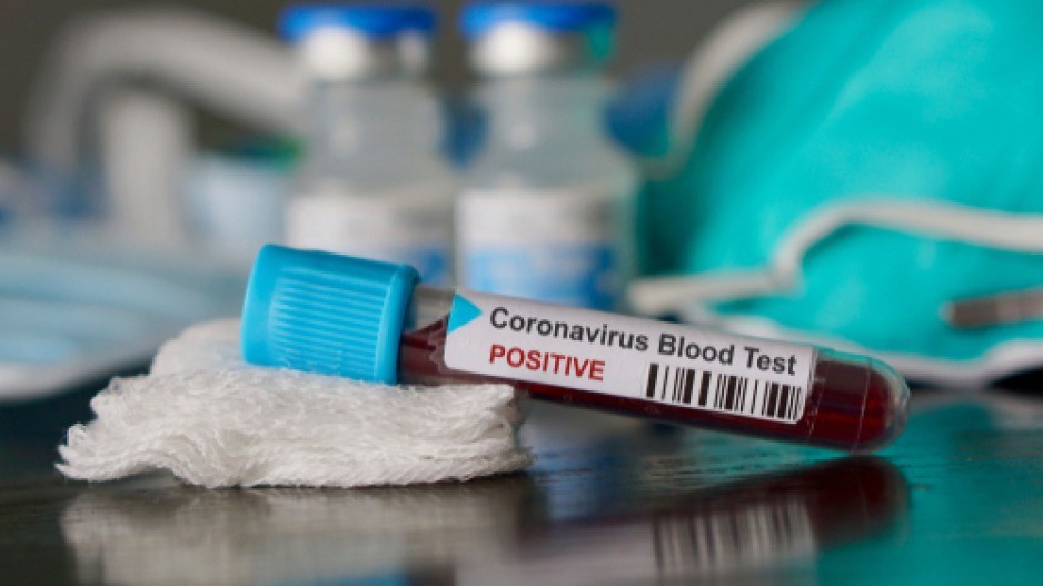 coronavirus-positive-blood-test-shutterstock