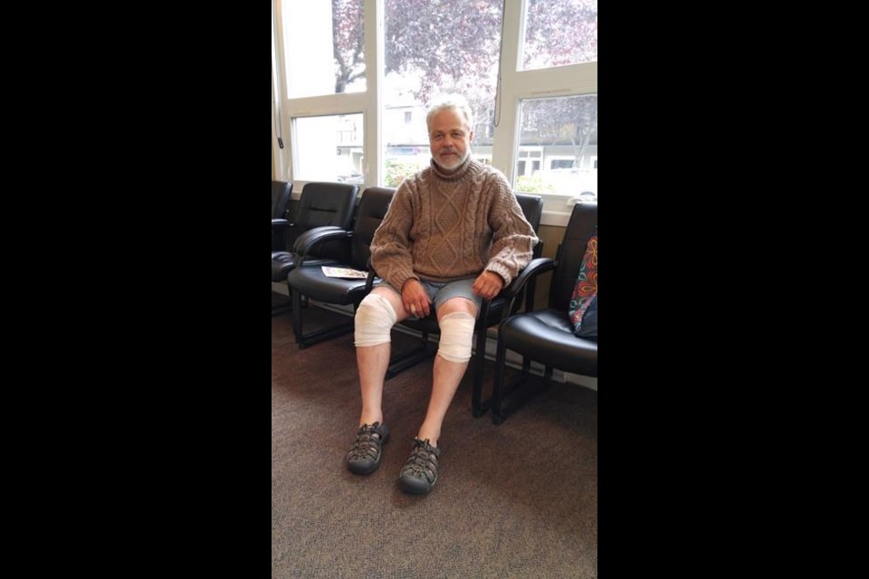 Randal Warnock fought off a bear that attacked him as he was beachcombing on a beach at Brown Island. He suffered gashes and punctures to his legs. July 2017.