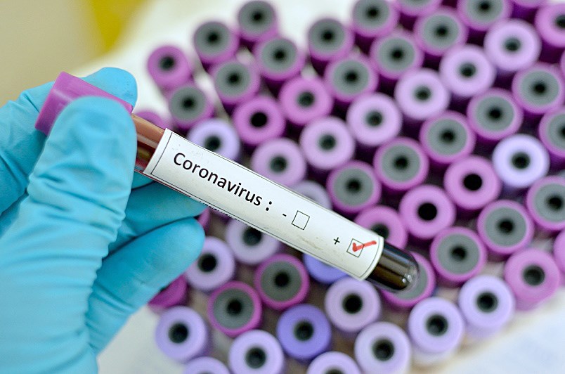 vial with coronavirus label