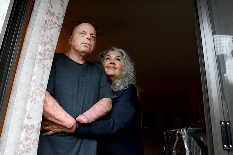 Rick Thompson and his wife, Rita, are packing up their Coquitlam apartment to move to London, Ont., where he hopes to become Canada's first recipient of a hand transplant. He lost both of his, as well as his legs, to sepsis.