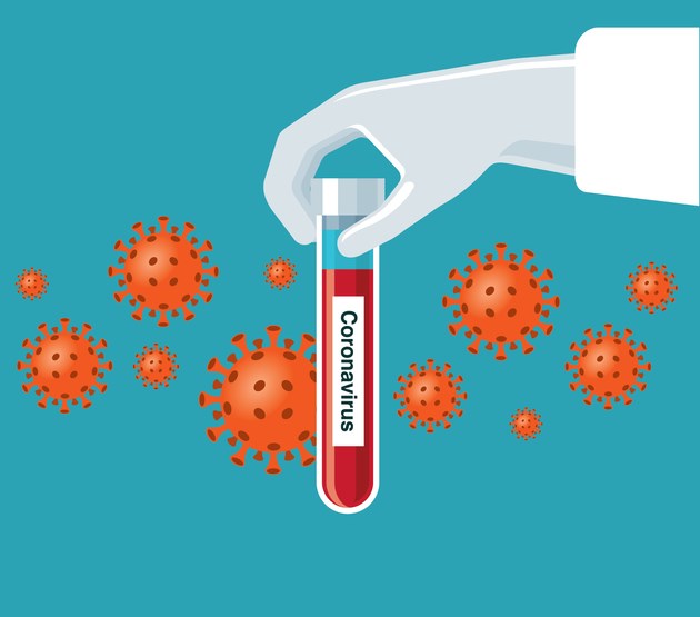 Serological tests could be a valuable tool for understanding and battling COVID-19.
