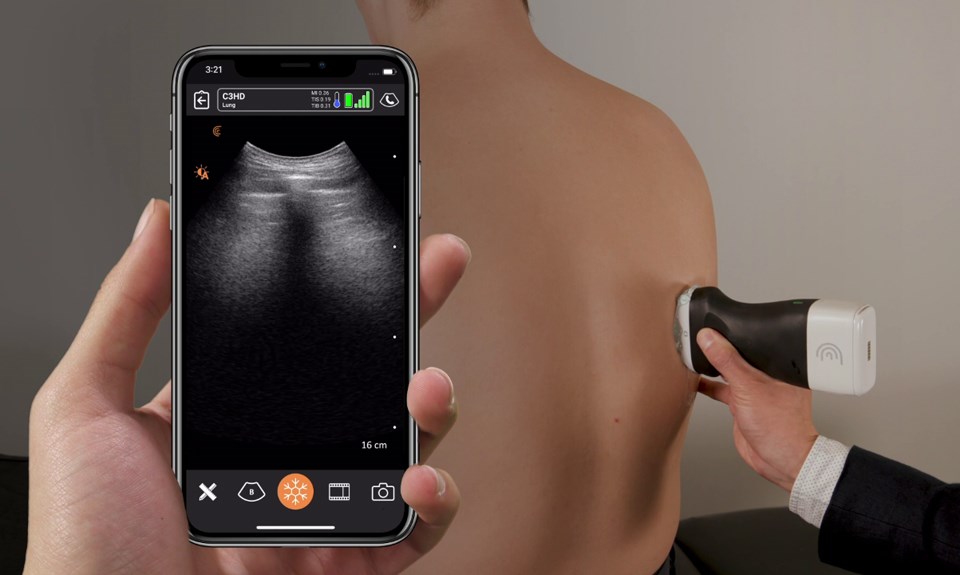 Clarius, pocket ultrasound