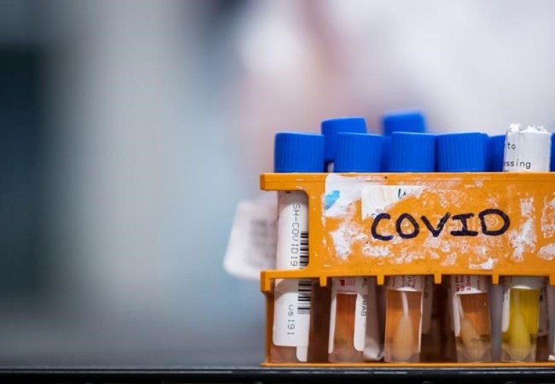 Specimens to be tested for COVID-19 are seen at a lab in Surrey, B.C., on Thursday, March 26, 2020.
