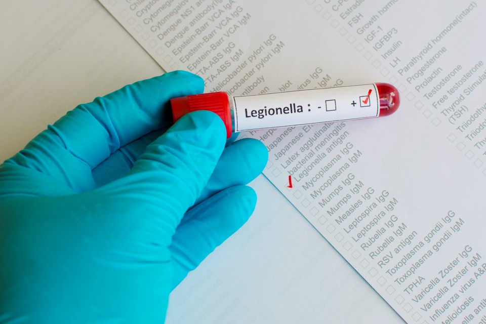 legionella, stock photo