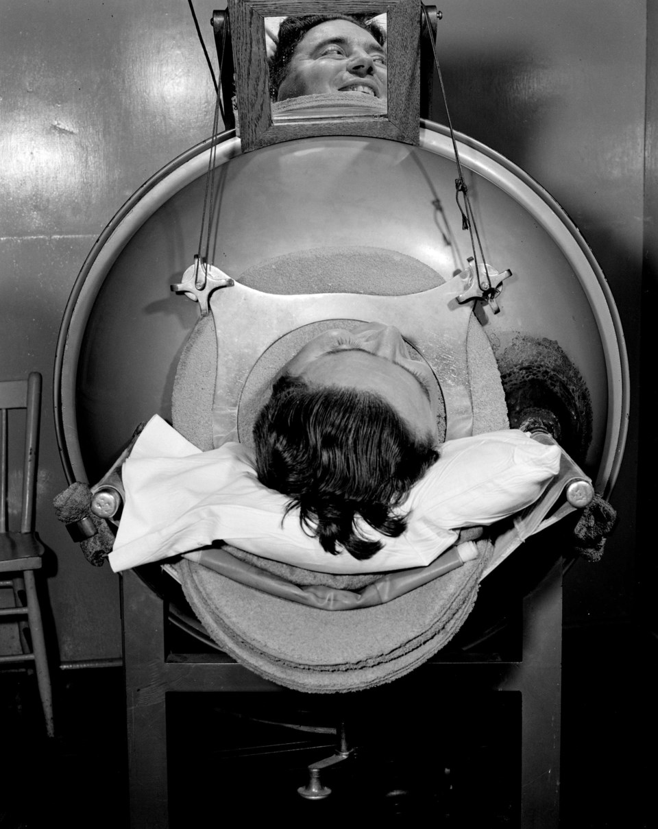 A person in an iron lung in Vancouver. The photo was taken between 1940 and 1948.