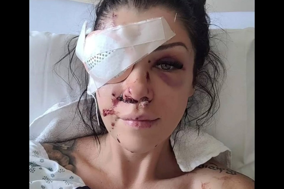 Regina Hampson was shot in the hand and face on Saturday, April 3, 2021. VIA CHEK NEWS