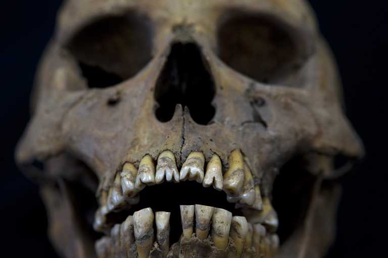 A skull with dental mutilations from the recently discovered Xaloctan site is displayed at the National Institute of Anthropological Studies at Mexico's National Autonomous University in Mexico City, Friday, Feb. 8, 2013. Archaeologists say they have turned up about 150 skulls of human sacrifice victims at a field in Xaloctan, central Mexico near the Teotihuacan pyramids. Experts are puzzled by the unexpected find of such a large number of skulls at what appears to have been a small, unremarkable shrine. The heads were carefully deposited in rows or in small mounds, mostly facing east toward the rising sun, sometime between 660 and 860 A.D. (AP Photo/Dario Lopez-Mills)