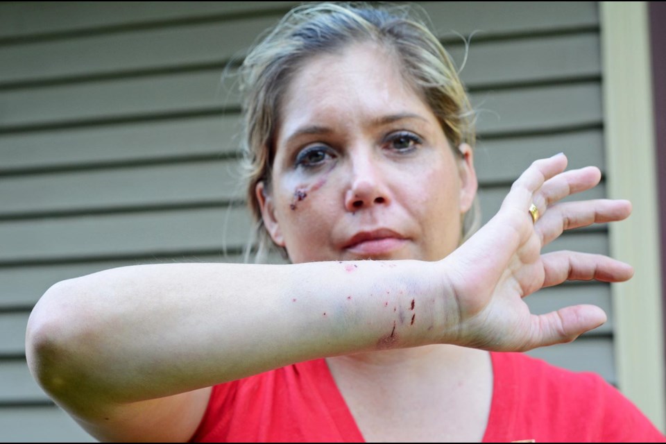 Battered and bruised: Bryn Erin Ward is recovering after being attacked by a cat on Tuesday night while showing a client a home in New West. The attack left her with five stitches on her face, a black eye and cuts to her legs and arms.