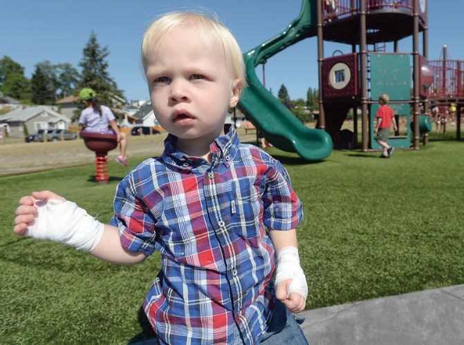 Toddler-burned-on-slide.01.jpg