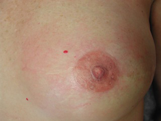Tattoo artist specializes in nipples for breast cancer survivors - Vancouver Is Awesome Tattoo artist specializes in nipples for breast cancer survivors - Vancouver Is Awesome