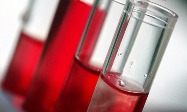 hivtesting