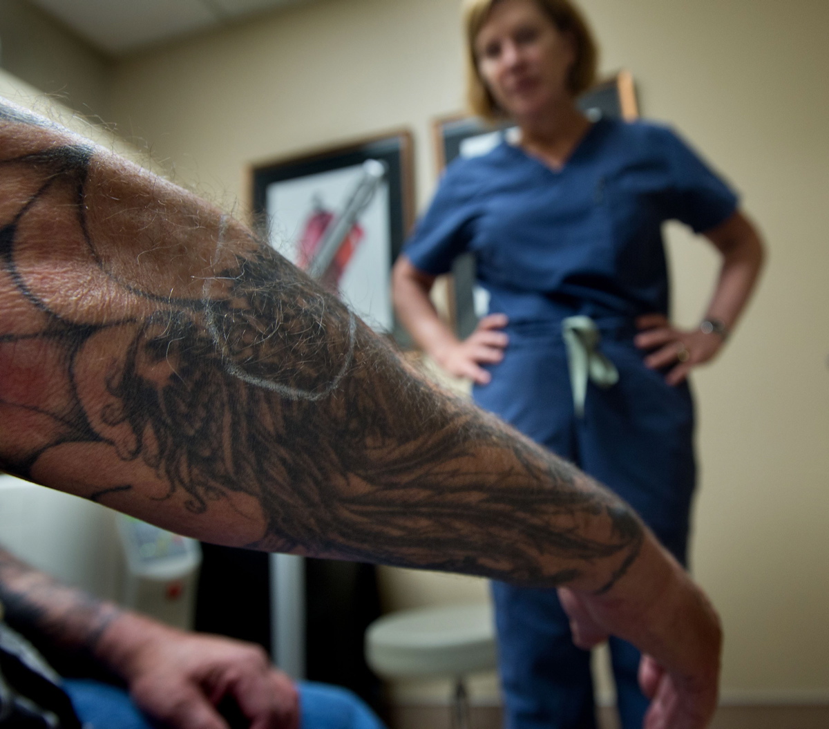 FDA Tattoo removal no simple process  CBS News