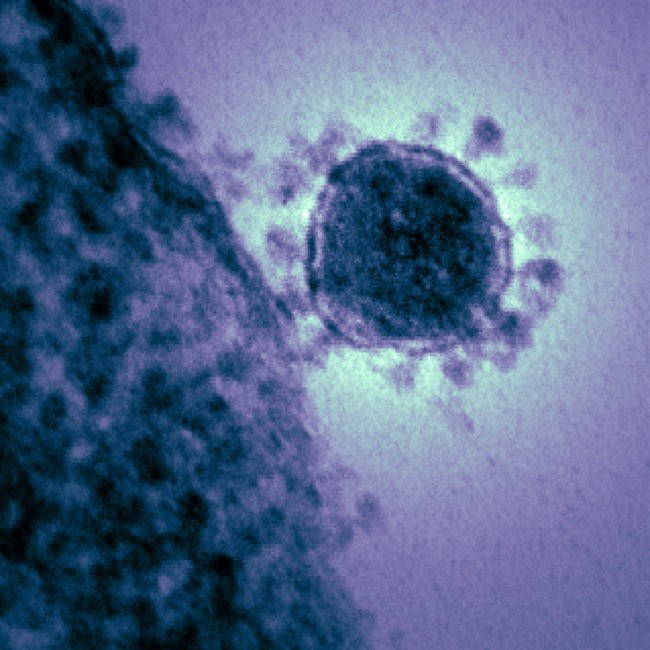 Coronavirus070376_high.jpg