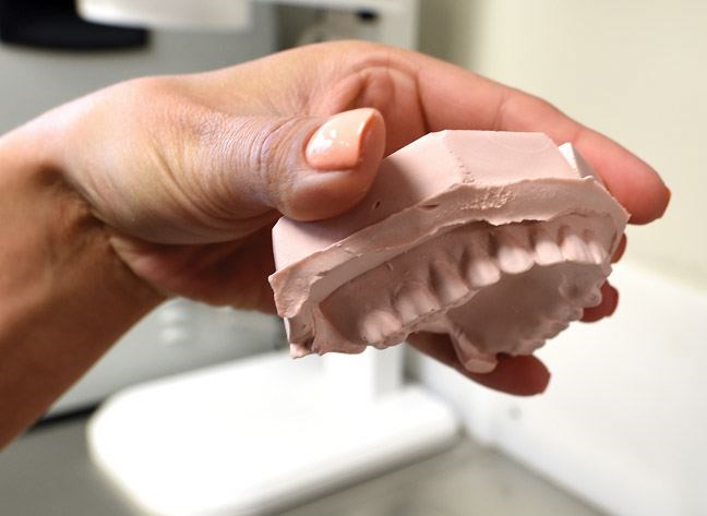 denturesside.15.jpg