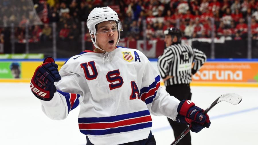 Auston Matthews is probably one of the guys in Jim Benning's top four.