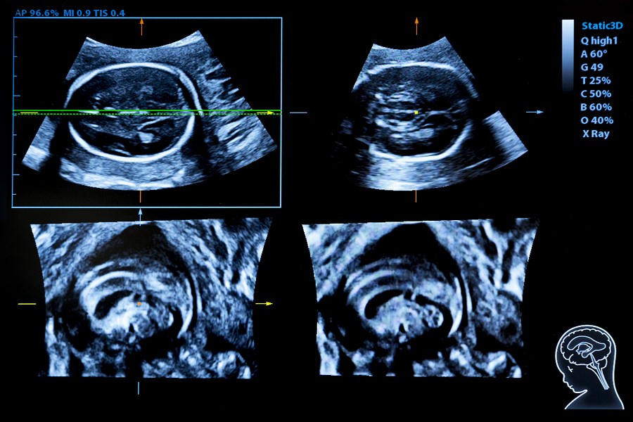 obstetrics