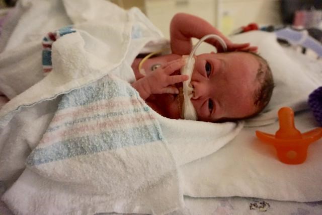 Premature baby