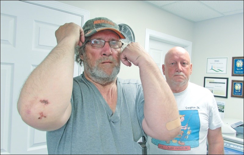 Dale Haugerud displays elbow injuries he sustained while trying to break his way through the ice while submerged in Kisseynew Lake. With him is friend Sheldon Wall.