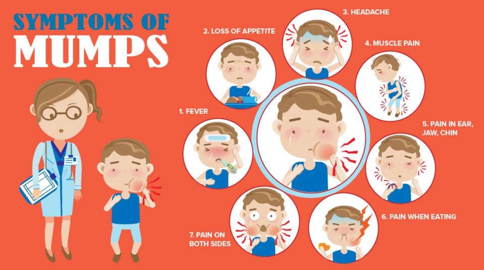 mumps symptoms