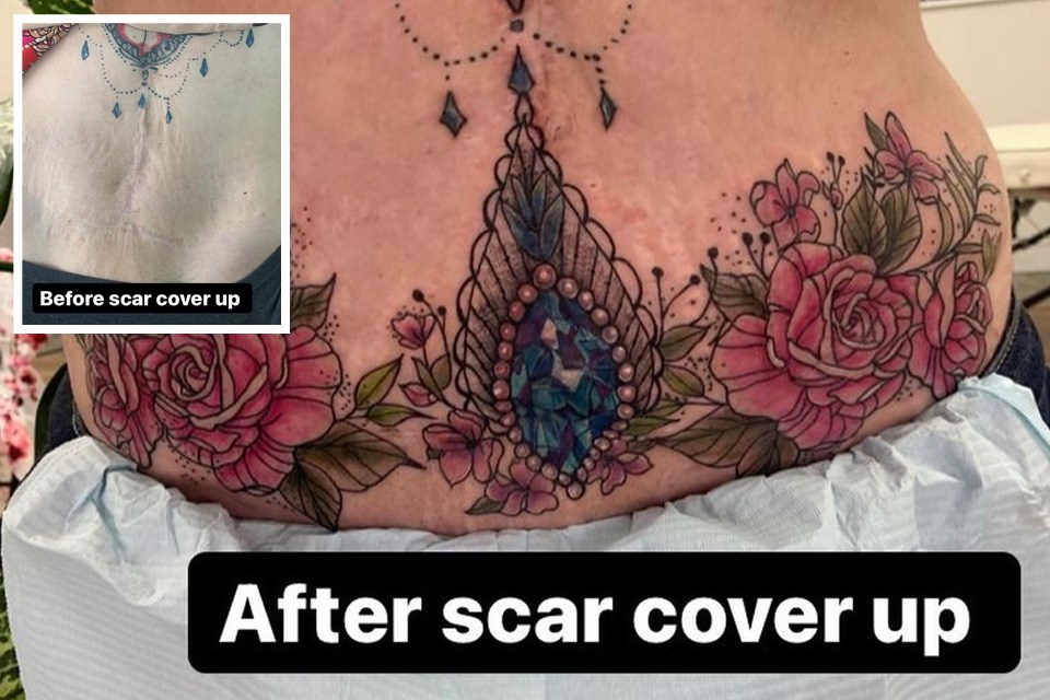 beforeafter