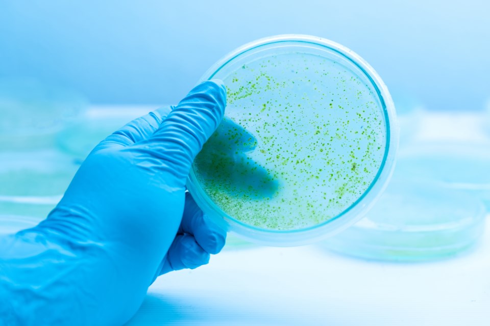 A stock photo of a colony of blue green algae in culture medium plate 