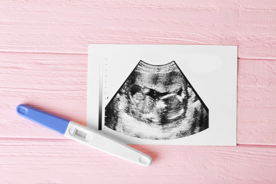 Pregnancy announcement