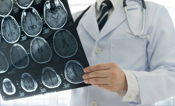 neurologist-boulder
